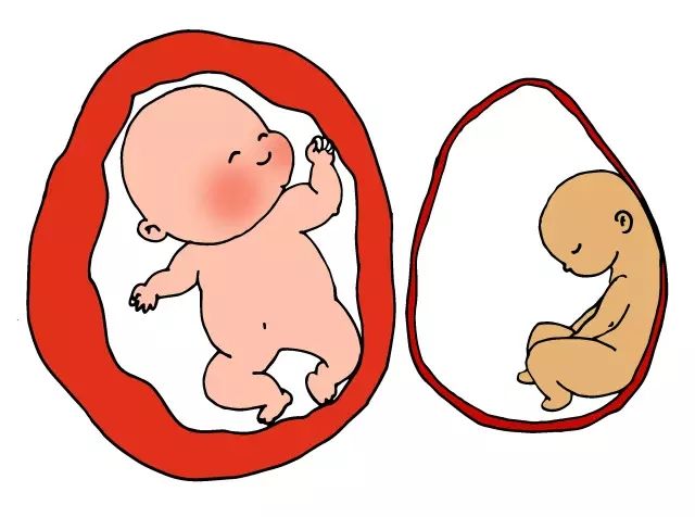 人流之后多久可以怀孕?备孕期间需要做好哪些准备?