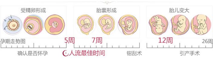 怀孕32天可以人流吗？人流，掌握时间是关键！