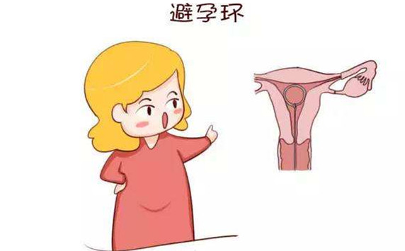 小编为你解答，白带异常可以取环吗?