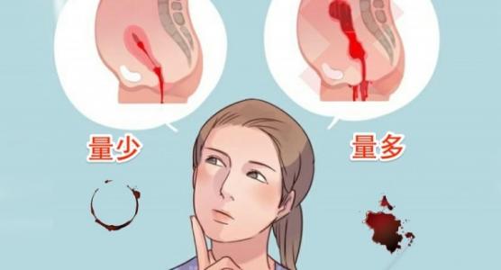 四十岁的女人月经量少是什么原因?7个月经量少的调理方法!