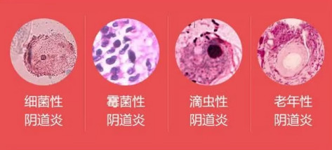 你好，我这几天下身有点瘙痒流暗红色的液体，这为什么?