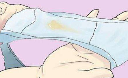淮安一次妇科检查大概要多少钱?白带像豆腐渣一样是妇科病吗?